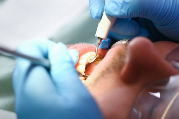 Best Urgent Dental Care in Fenton, MI
