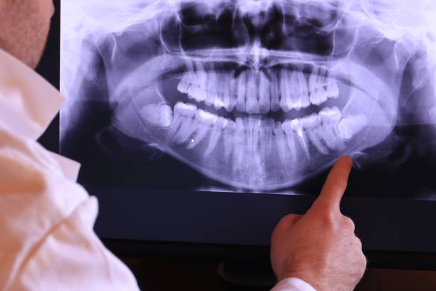Best Emergency Treatment for Toothache in Fenton, MI